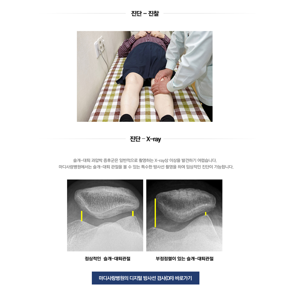 Patellofemoral hypercompression syndrome