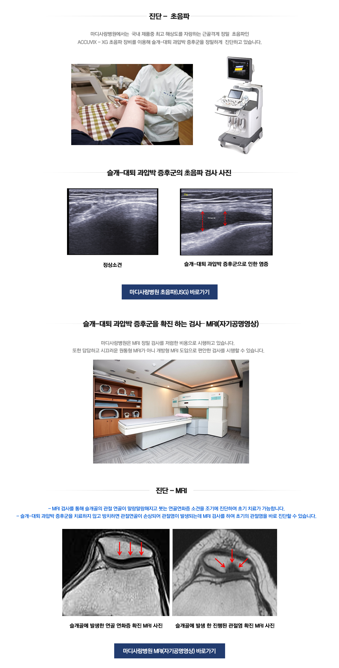 Patellofemoral hypercompression syndrome