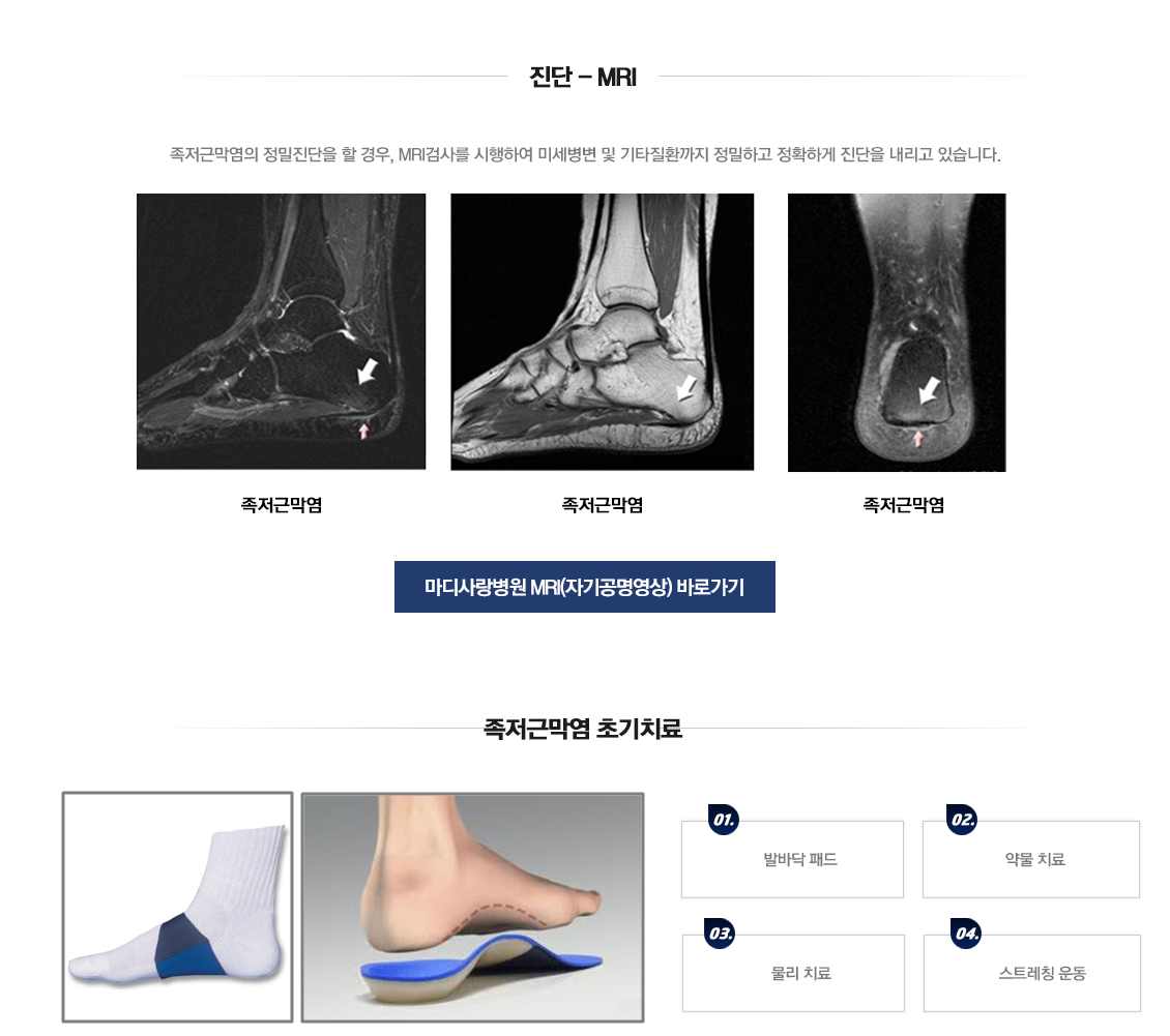 Plantar Fasciitis