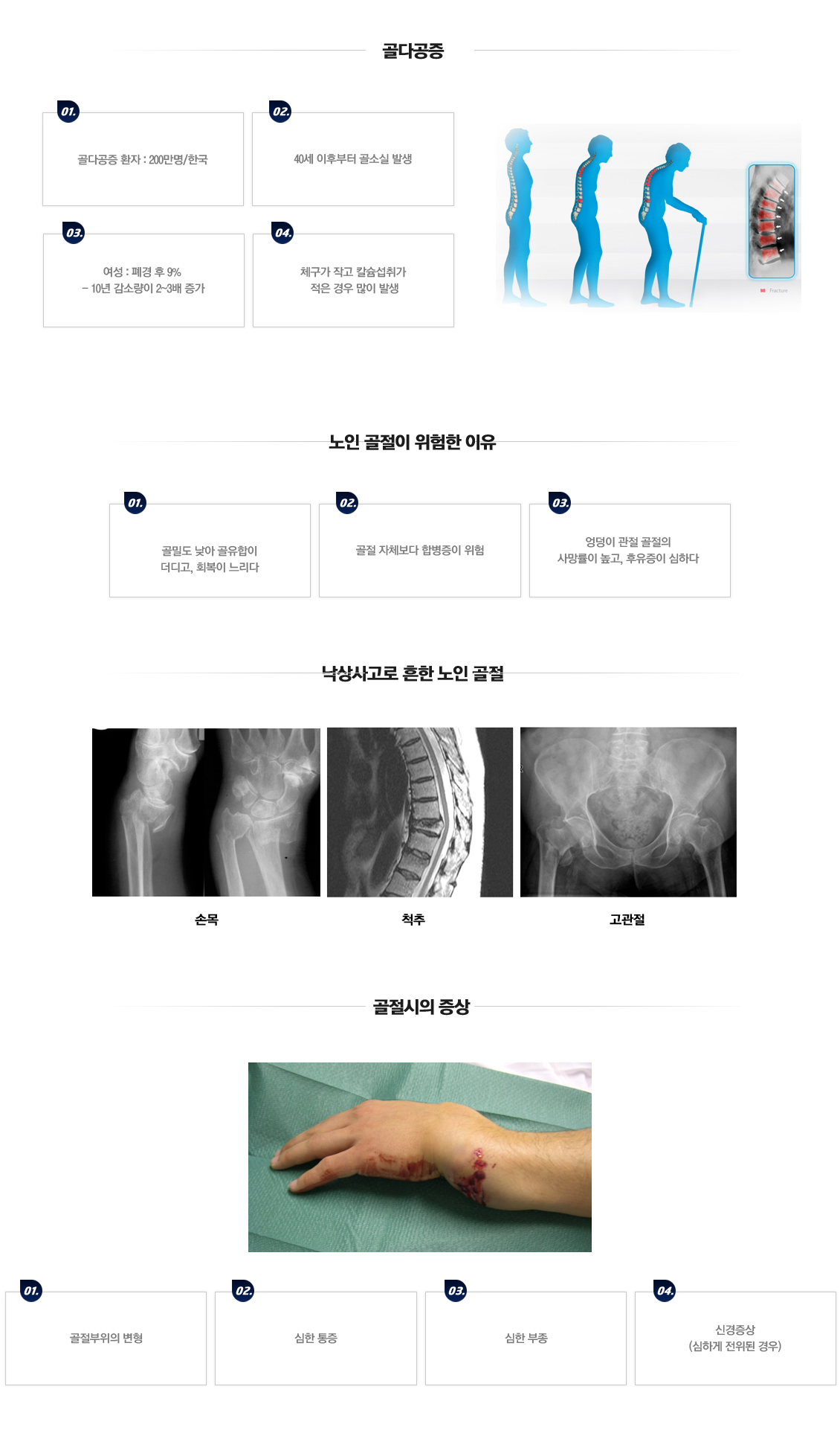 Fracture in Seniors 