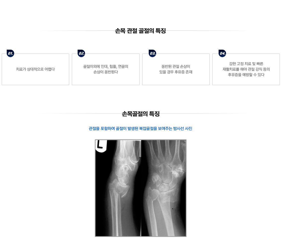 Fracture in Children