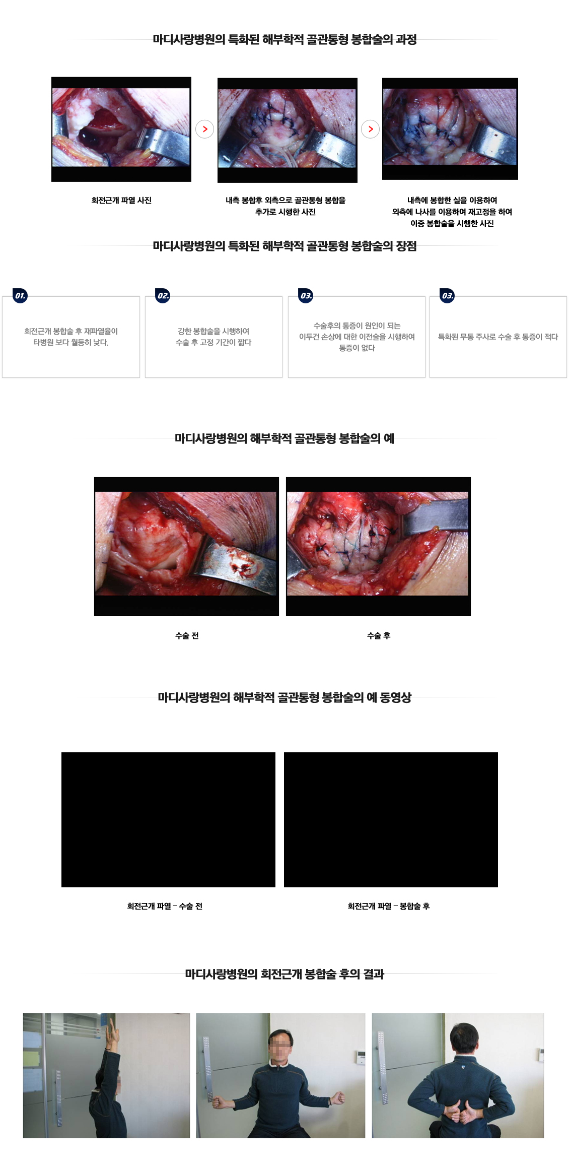 Impingement Syndrome