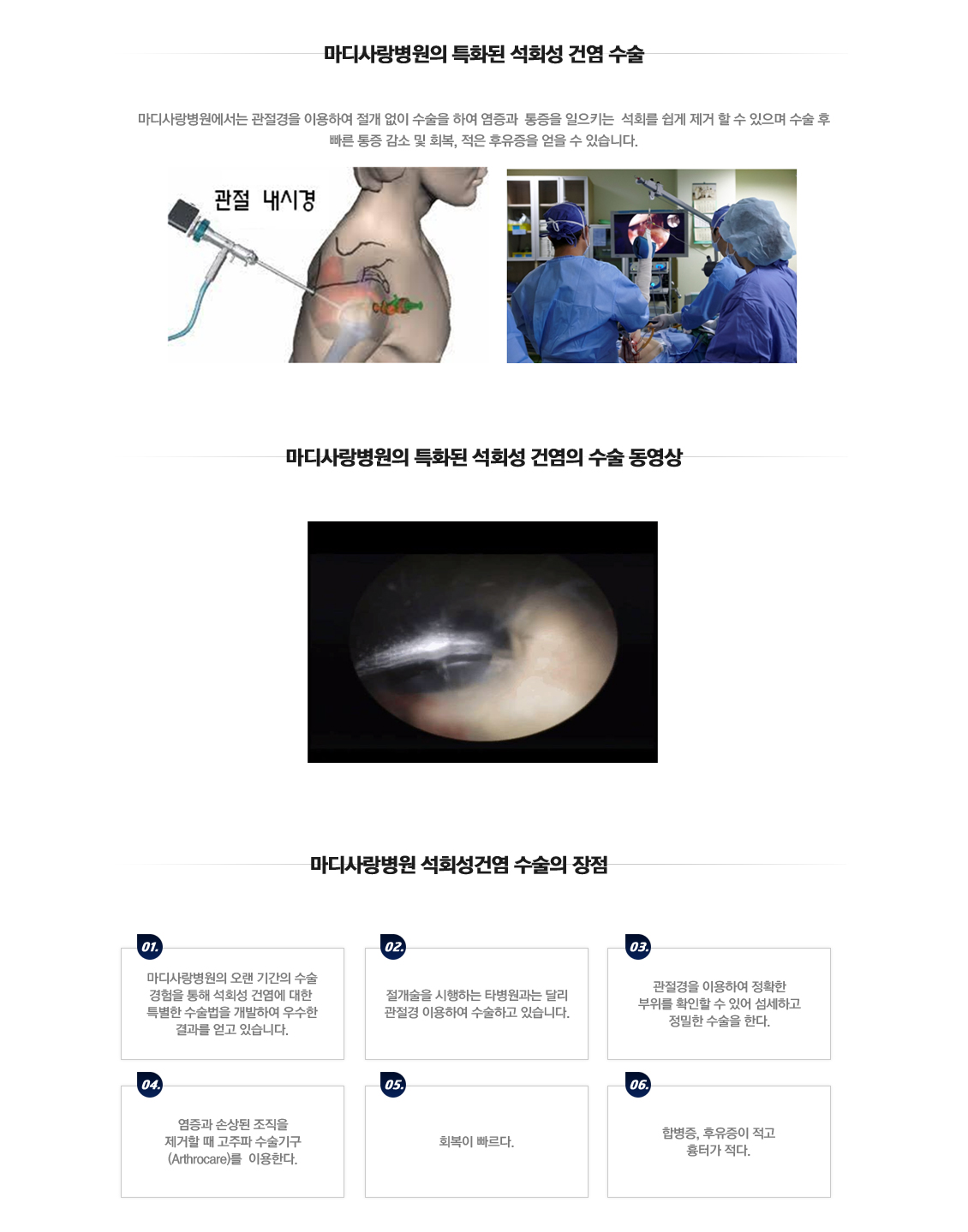 Calcific Tendinitis