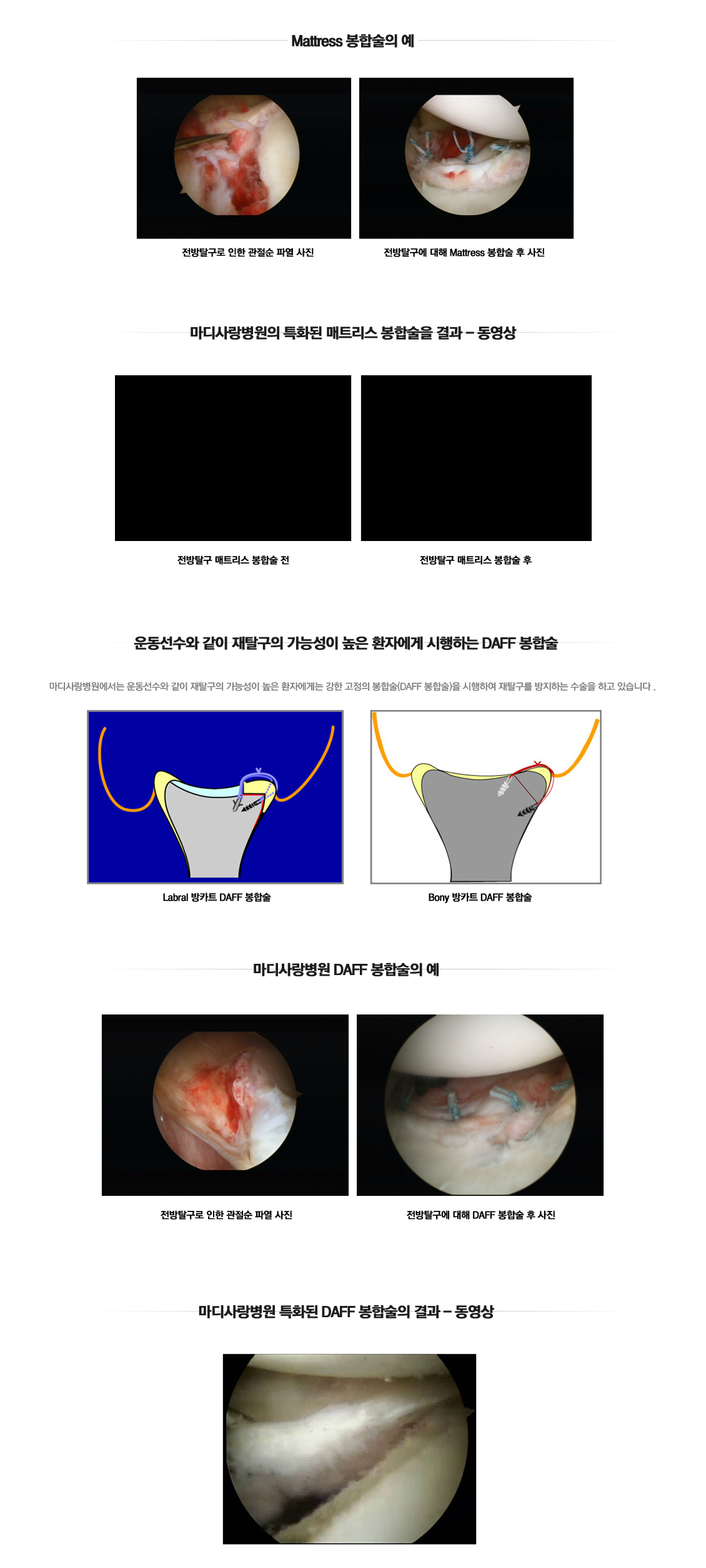 Traumatic Dislocation