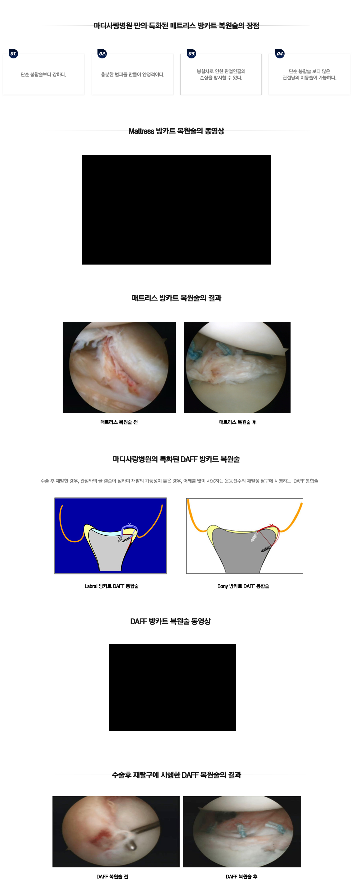 Recurrent Dislocation