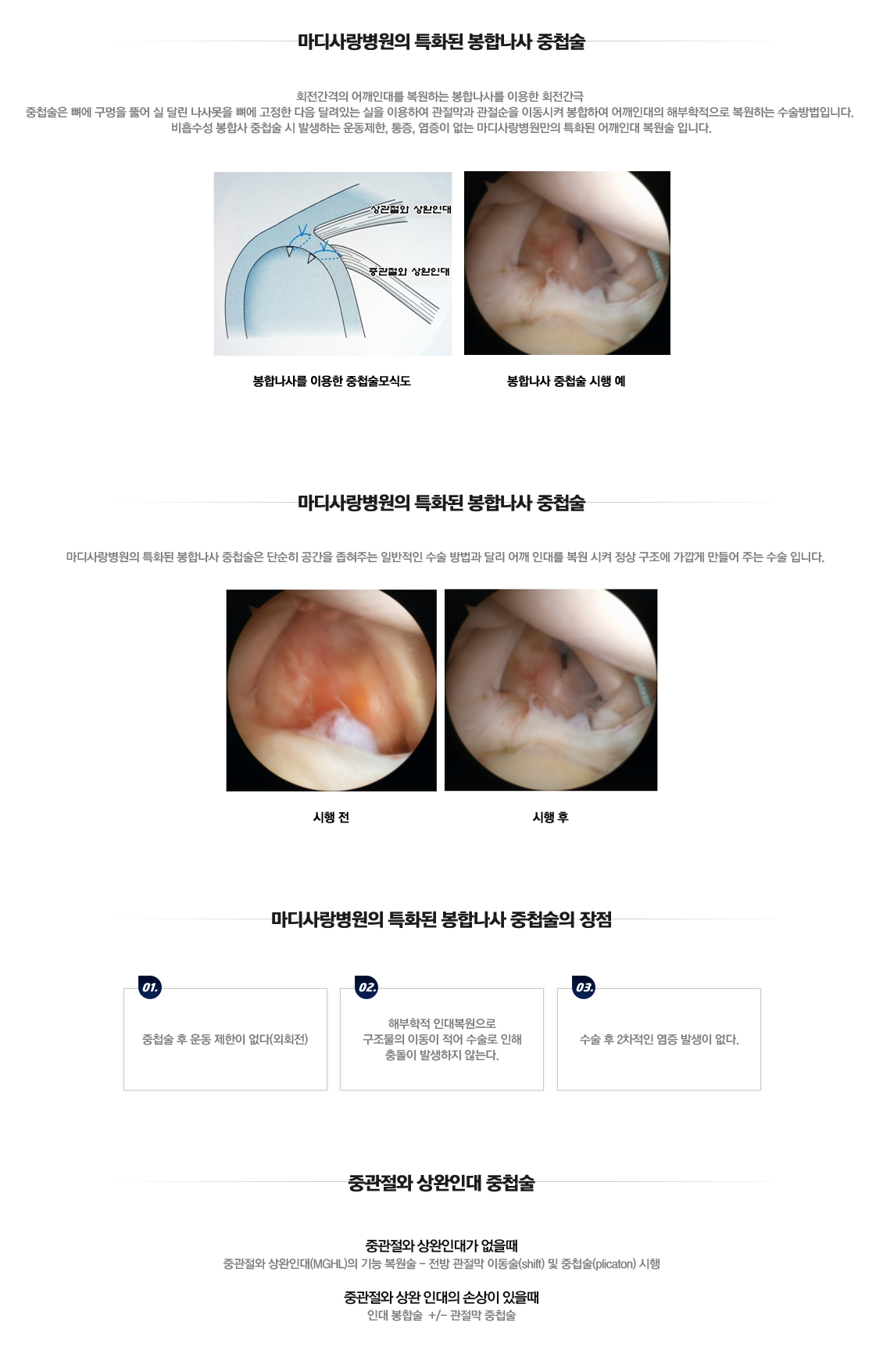 어깨 인공관절