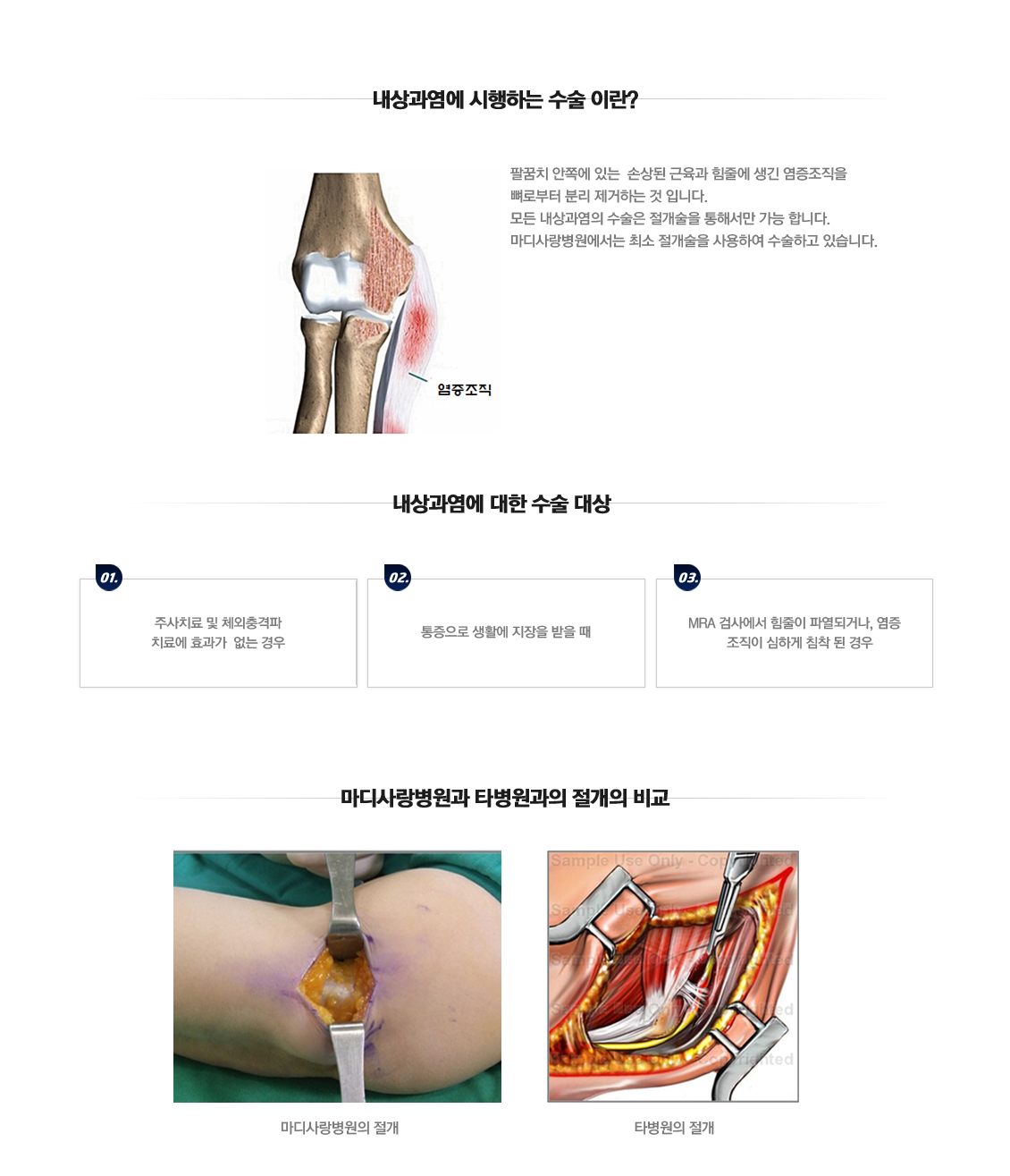 Medial Epicondylitis 