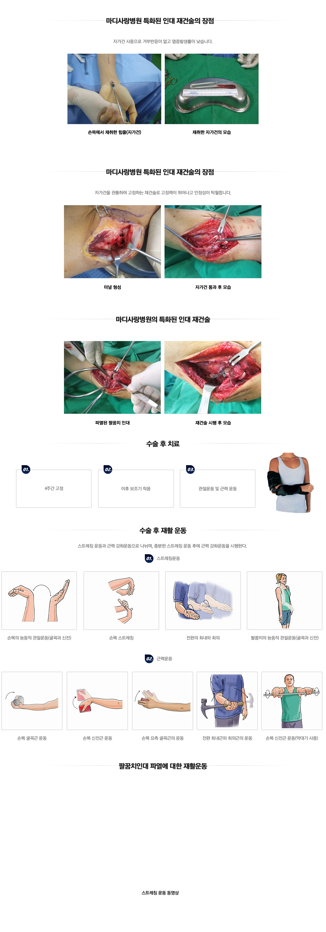 Lateral Epicondylitis