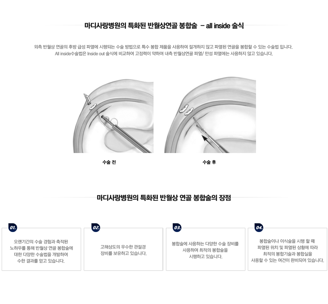 어깨 골절수술