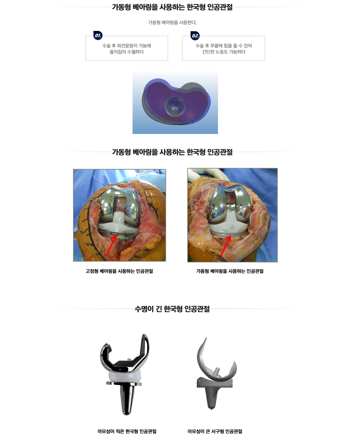 Total Joint Arthroplasty