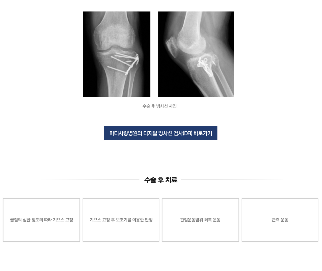 무릎 골절수술