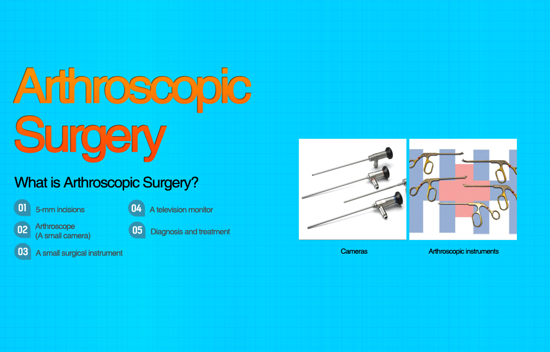 Arthroscopic Surgery