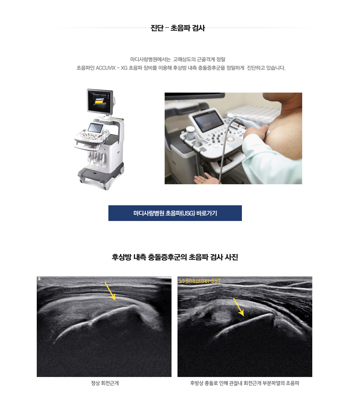 후상방내측충돌증후군