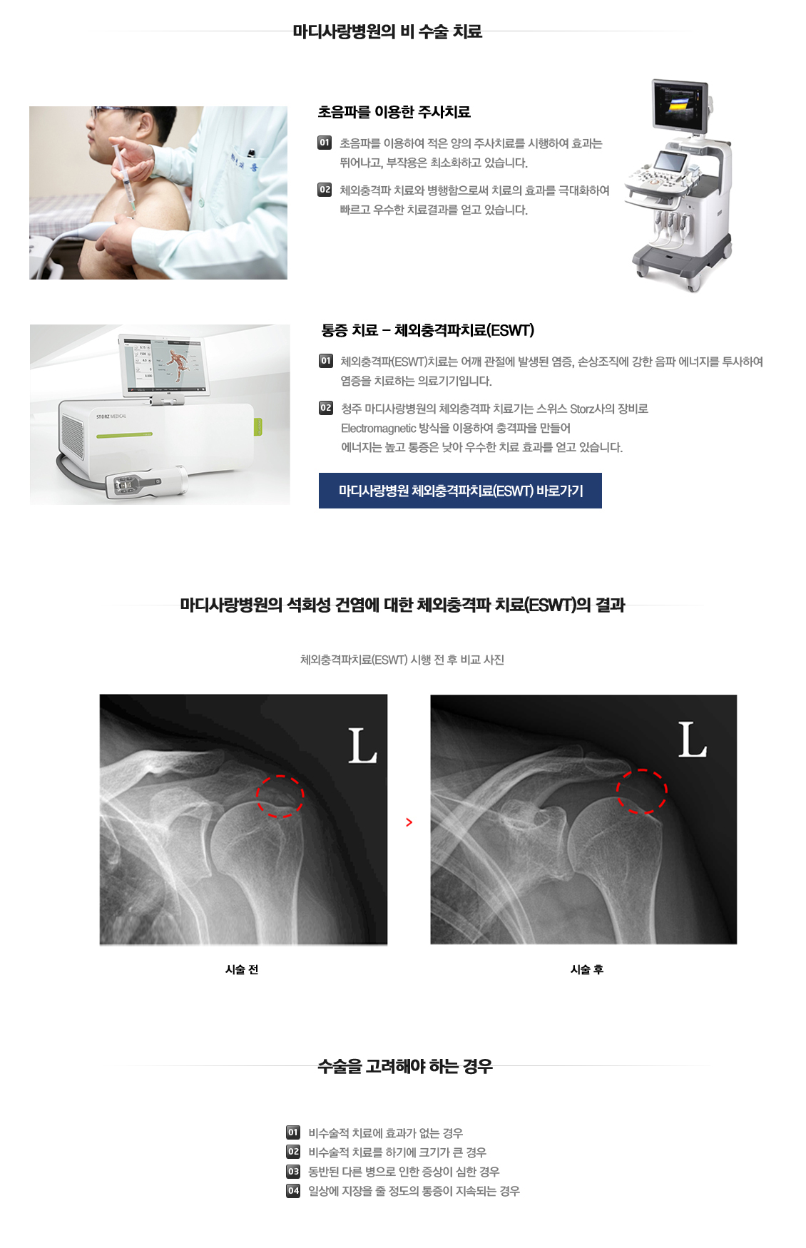 석회성건염