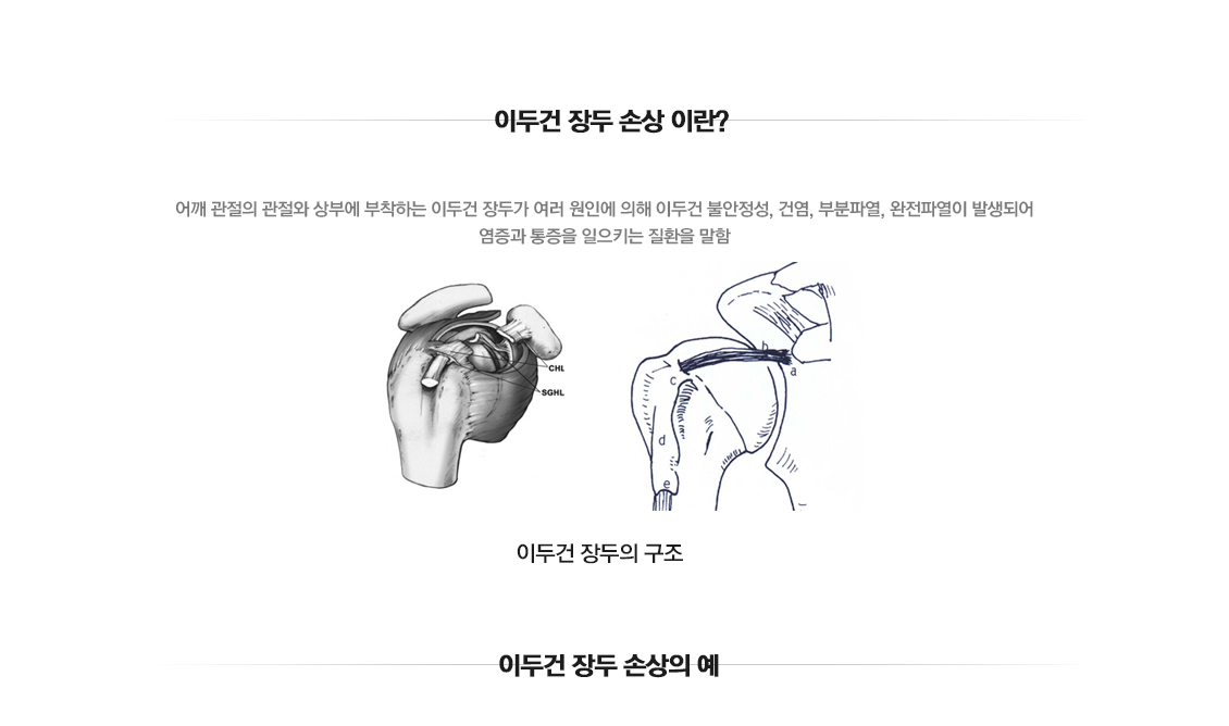 이두건 장두 손상