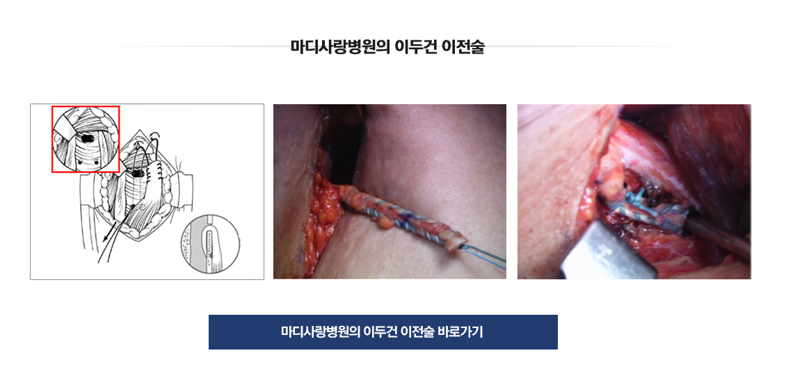 이두건 장두 손상