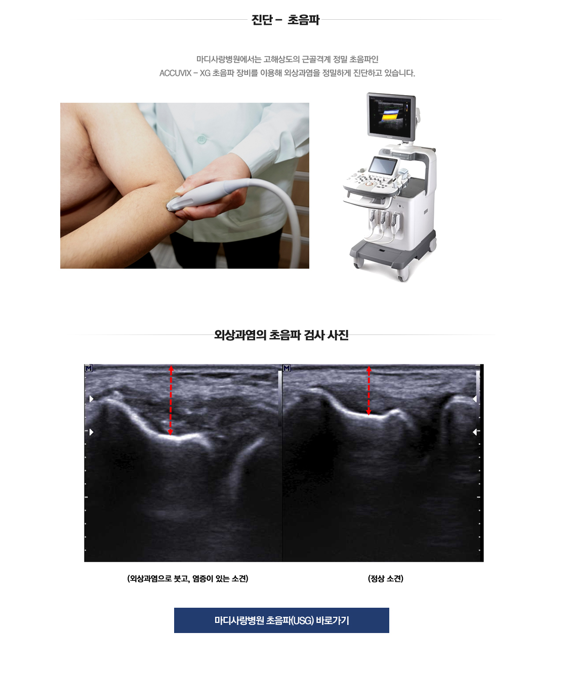 팔꿈치 증상별 진단 