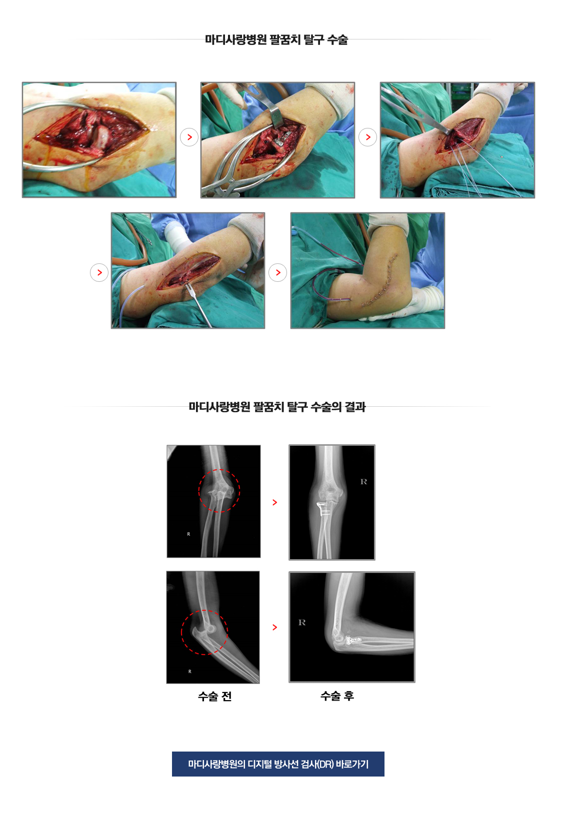 팔꿈치 증상별 진단 