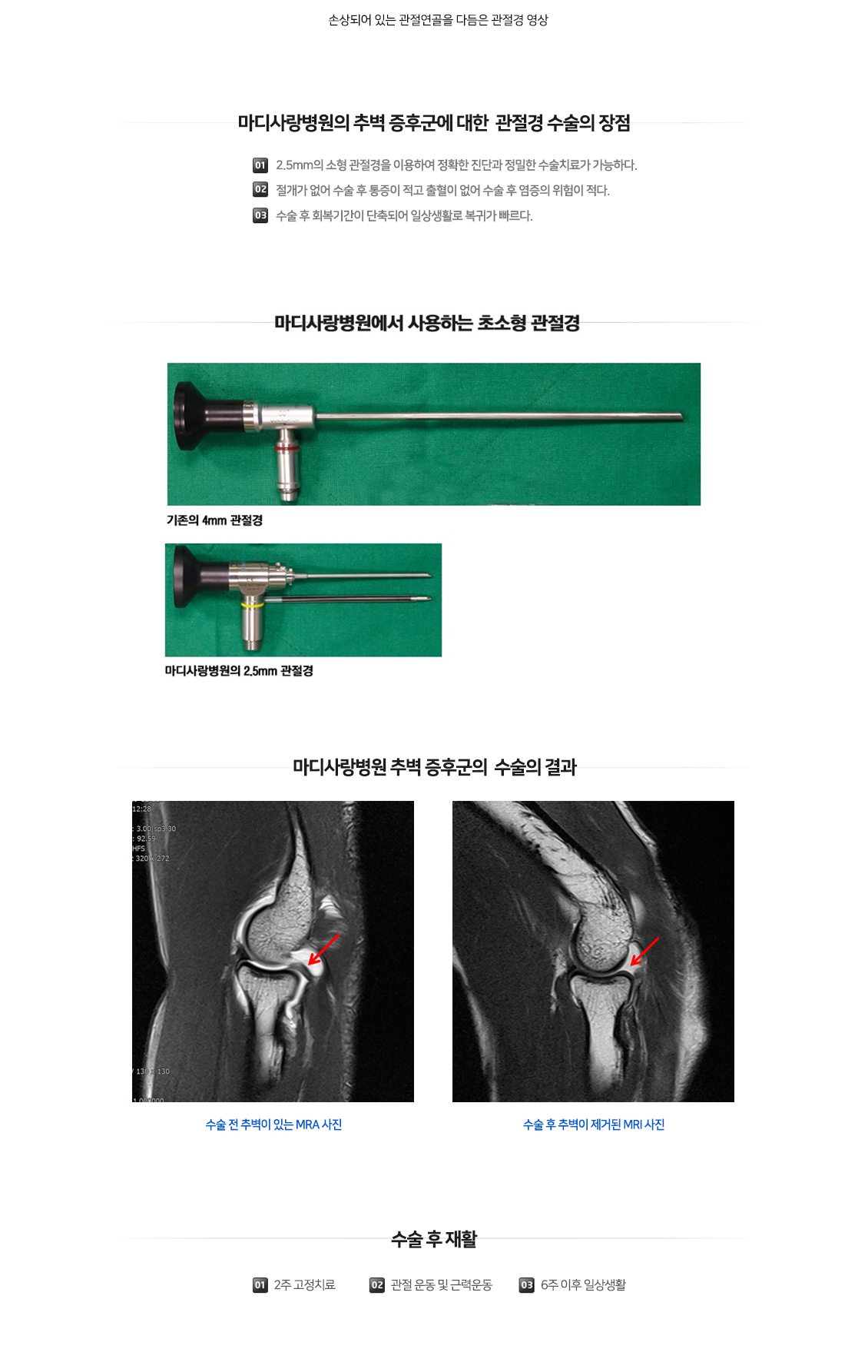 팔꿈치 증상별 진단