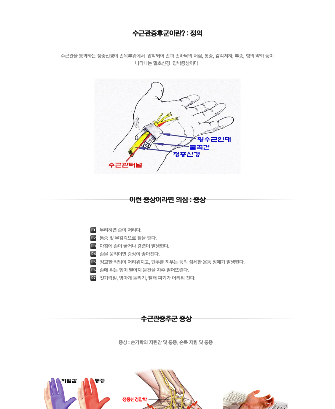 손목 증상별 진단 