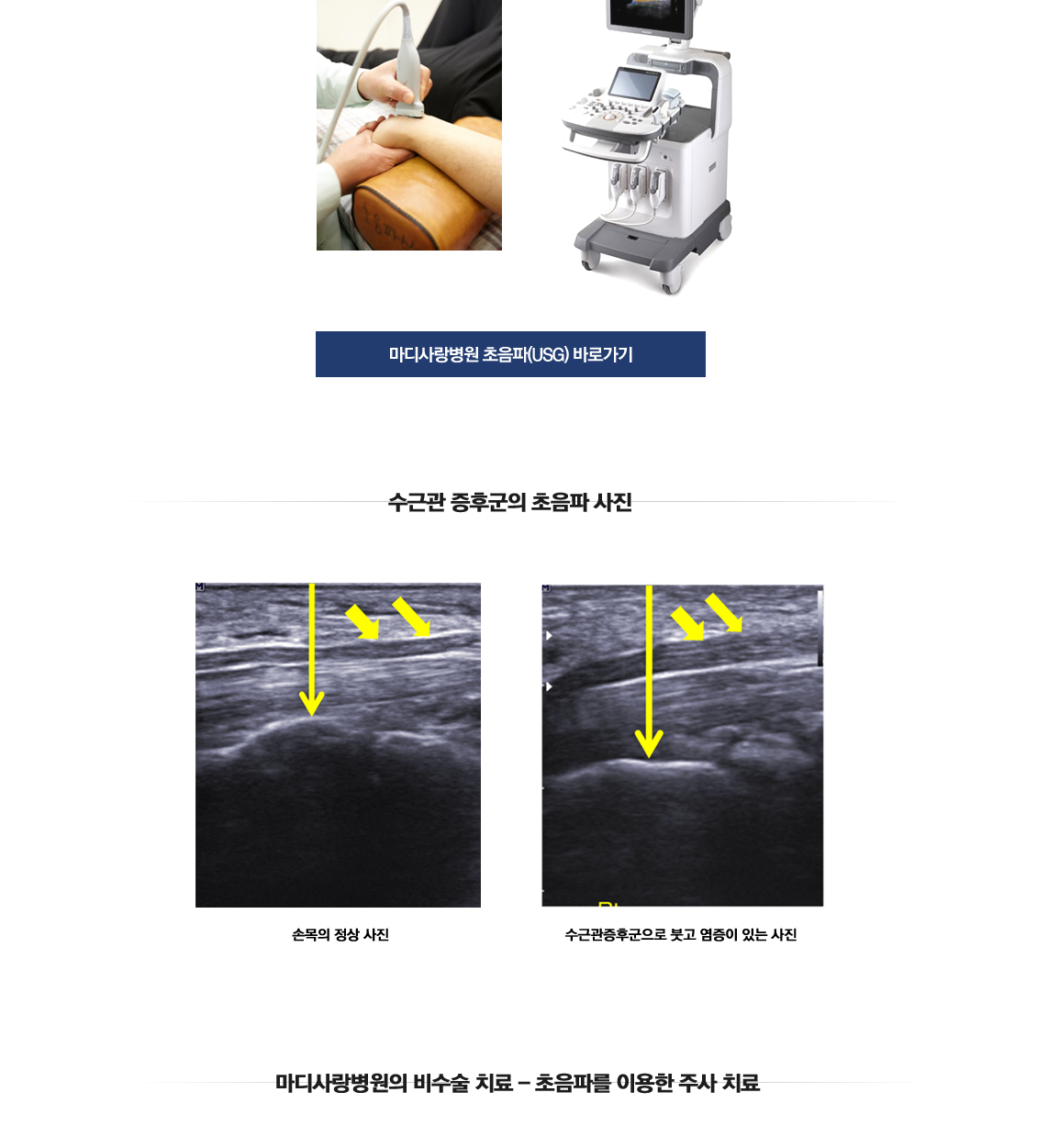 손목 증상별 진단 