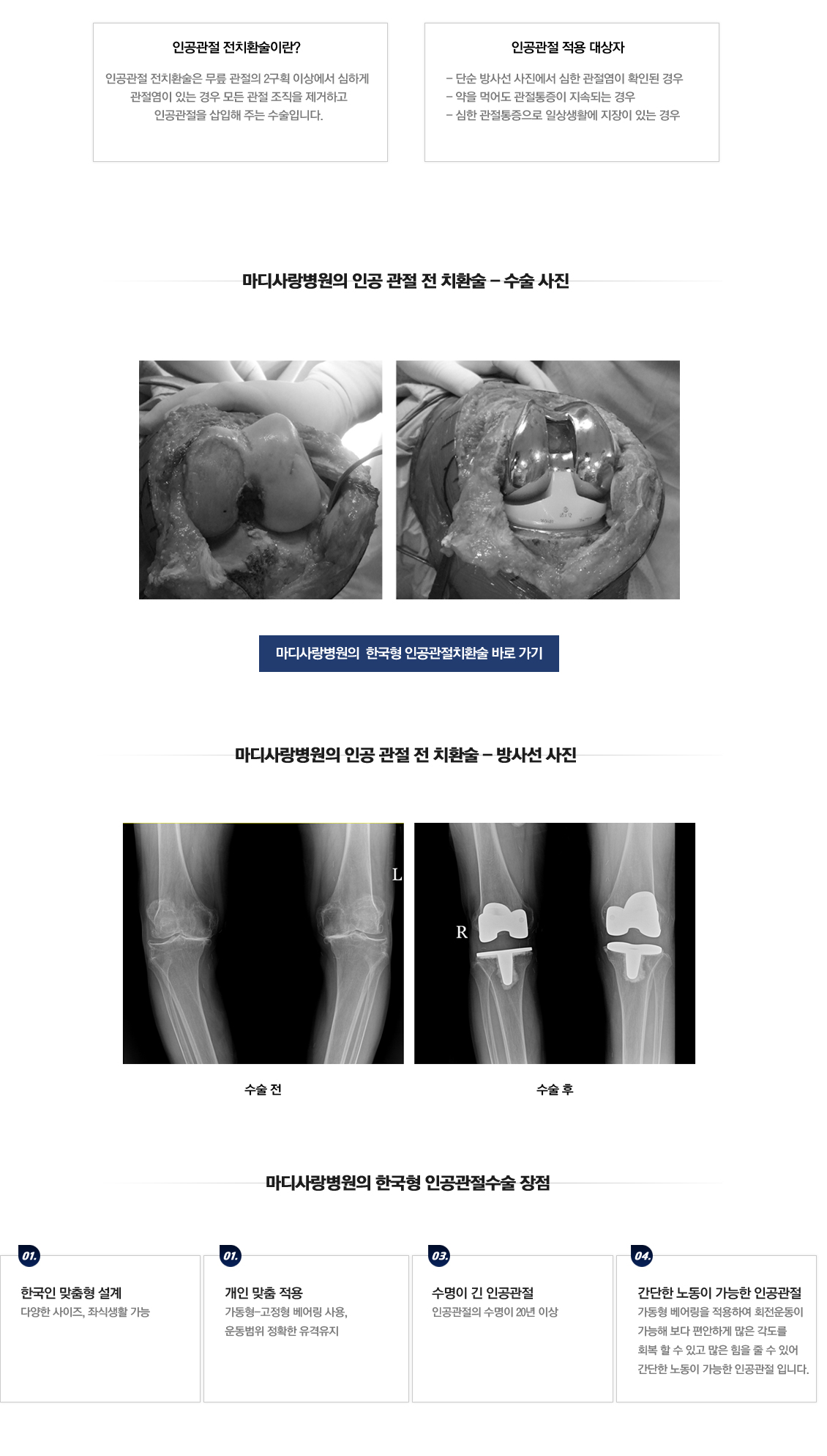 퇴행성관절염