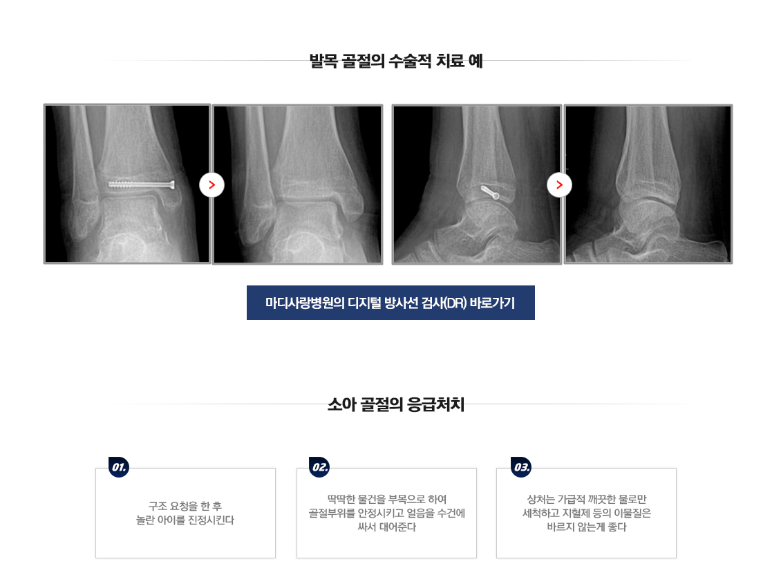 소아 골절