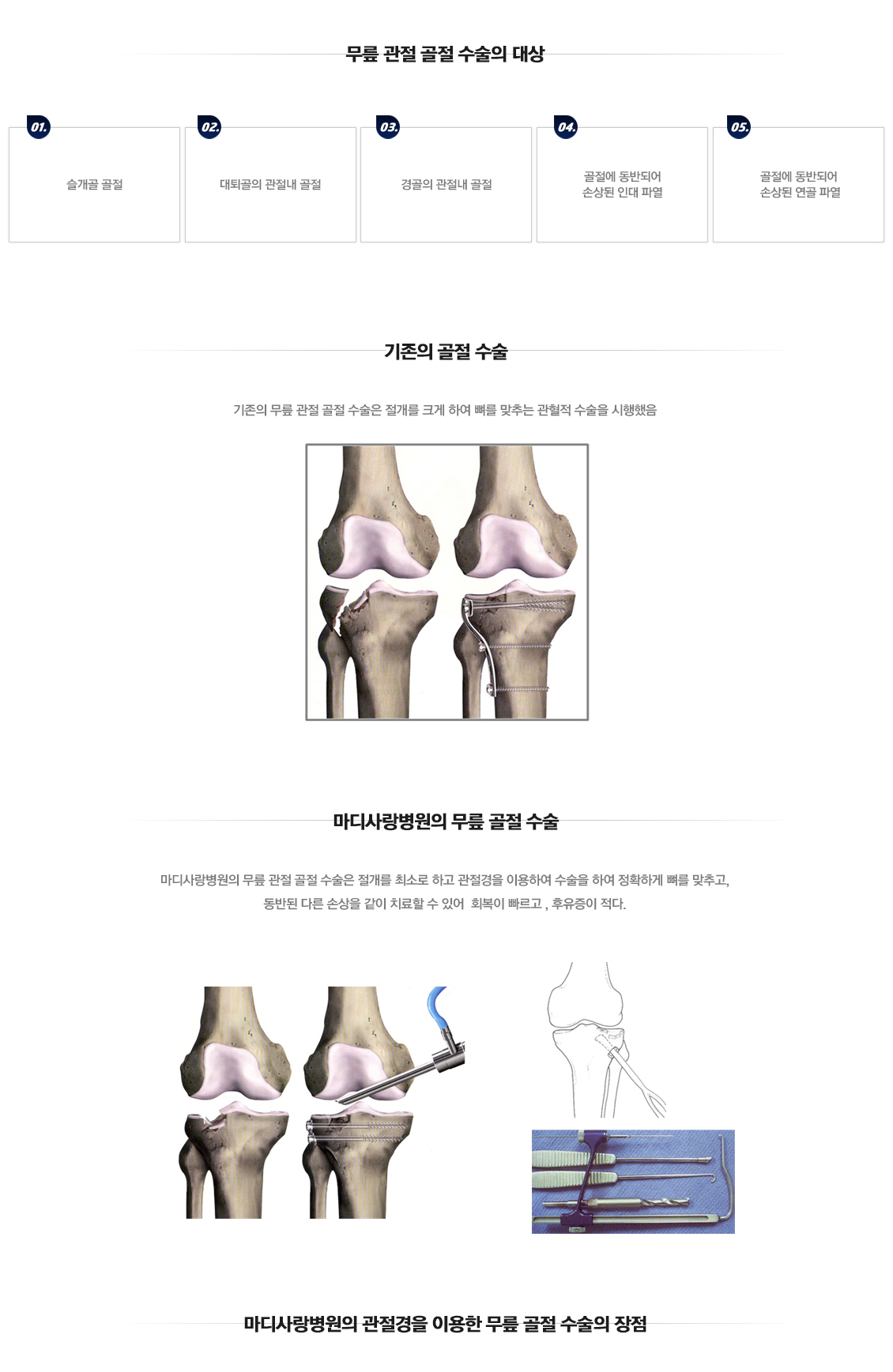 무릎 골절수술