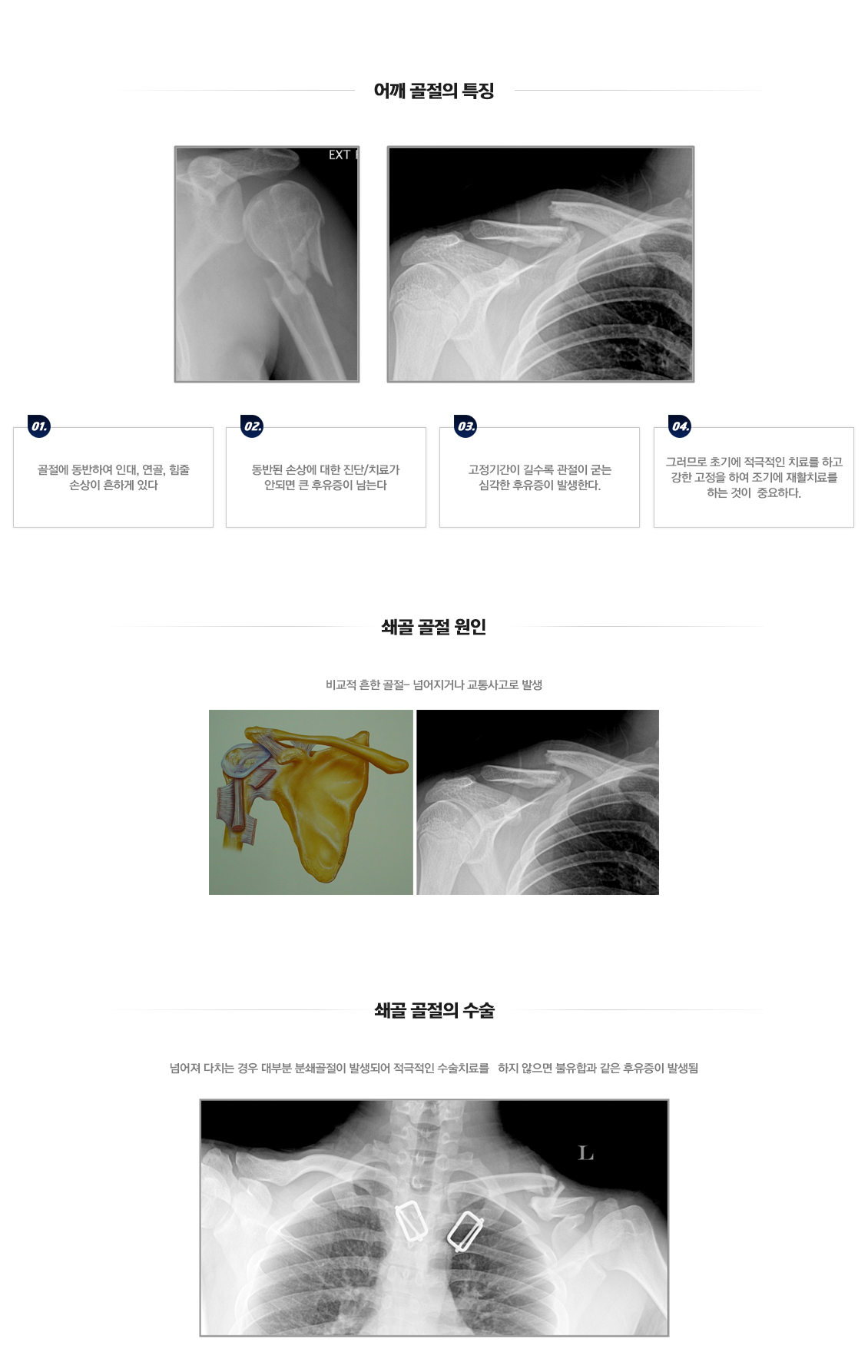 어깨 골절수술