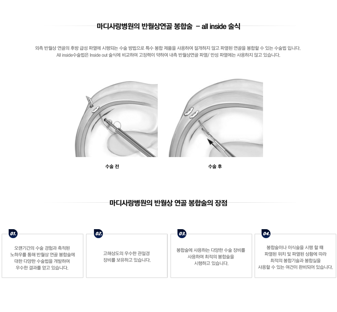 어깨 골절수술