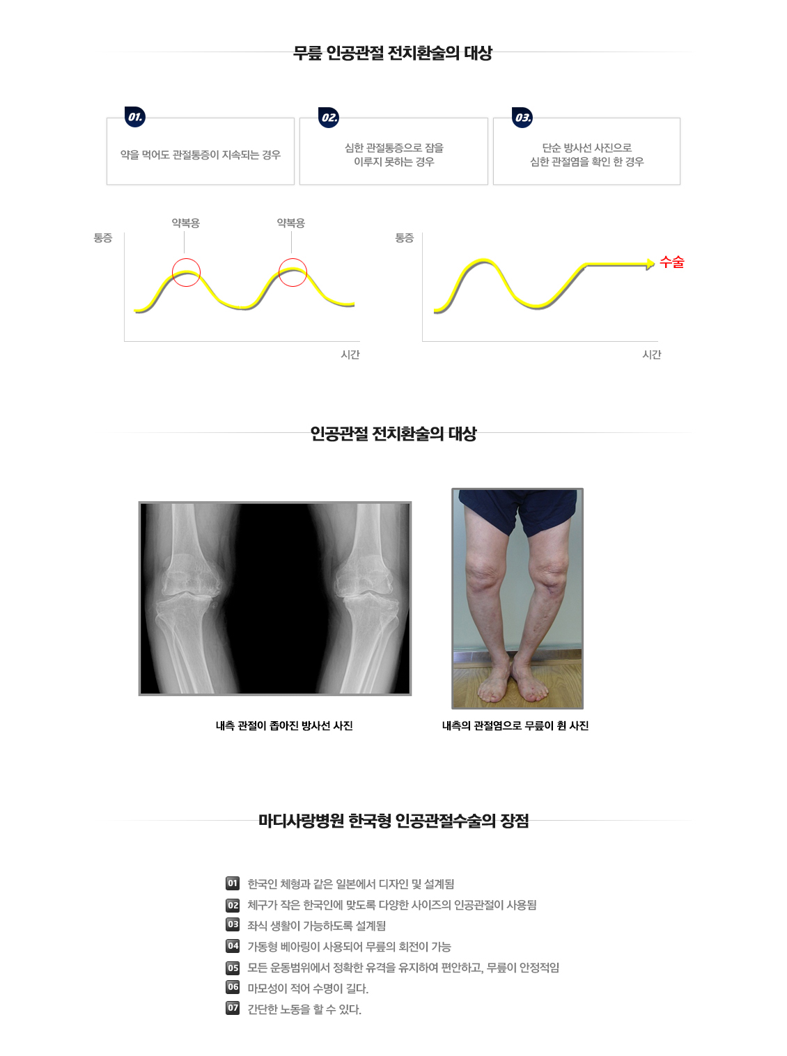 인공관절 전 치환술