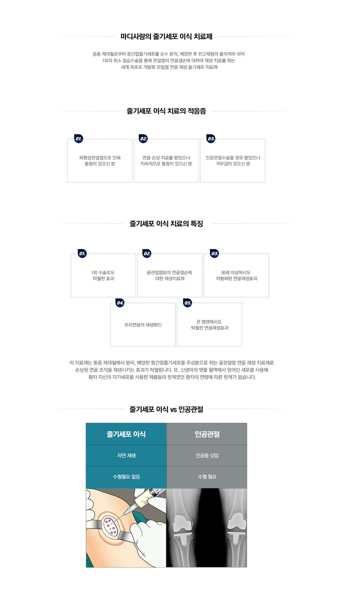 줄기세포 치료제(카티스템)