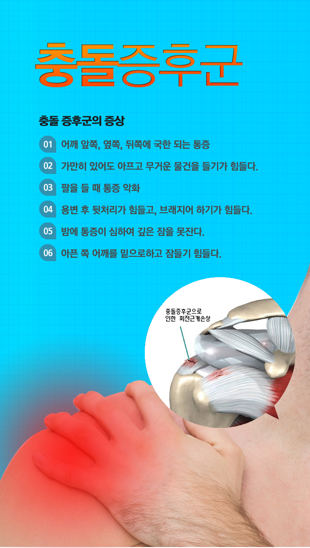 충돌증후군