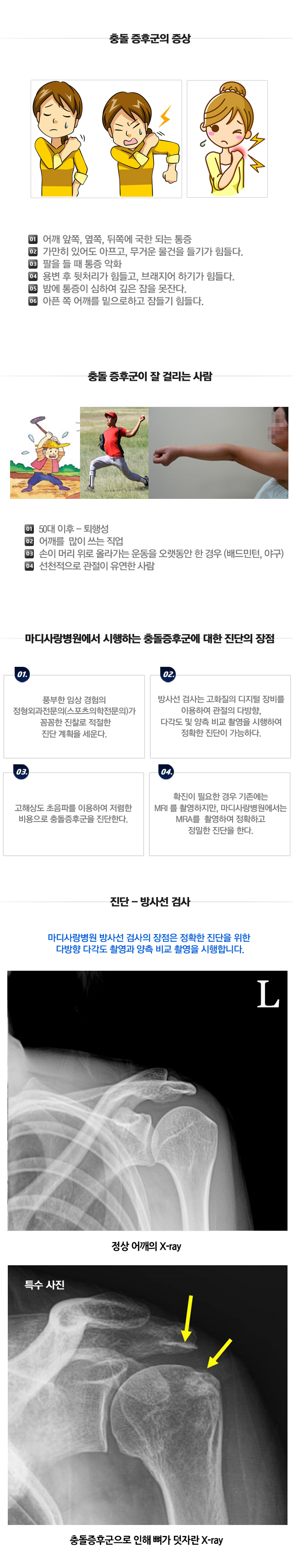 충돌증후군