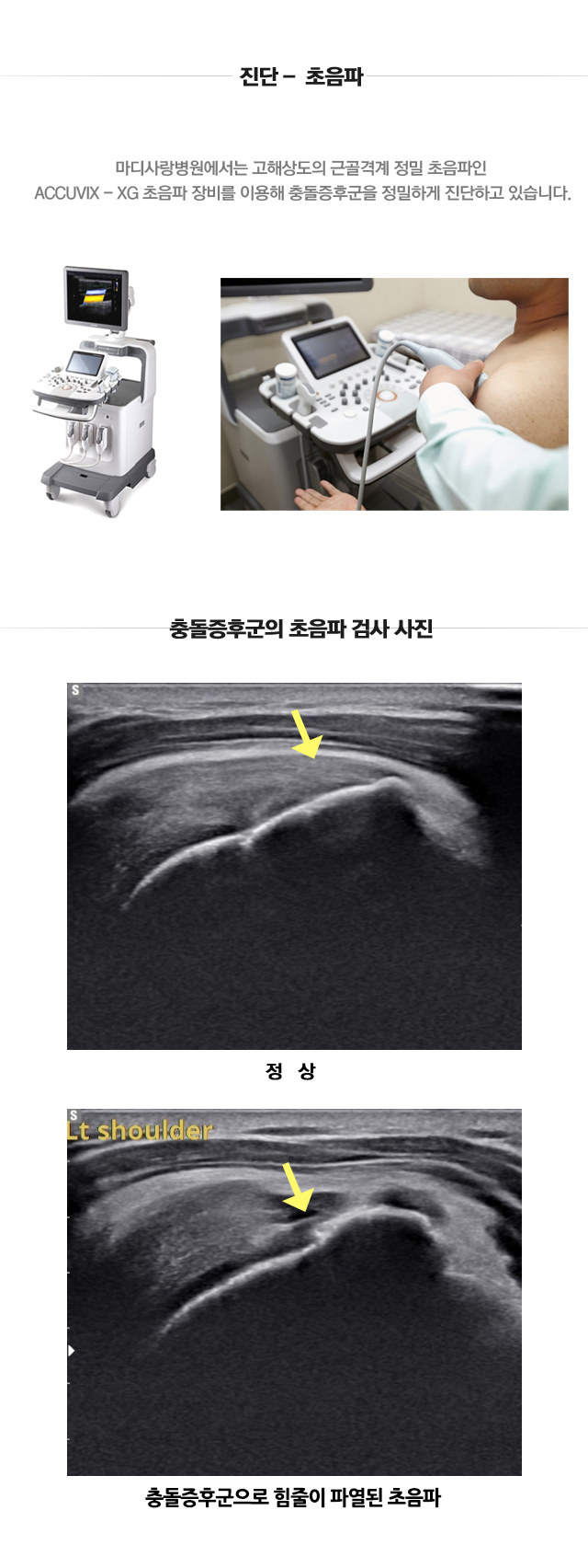 충돌증후군