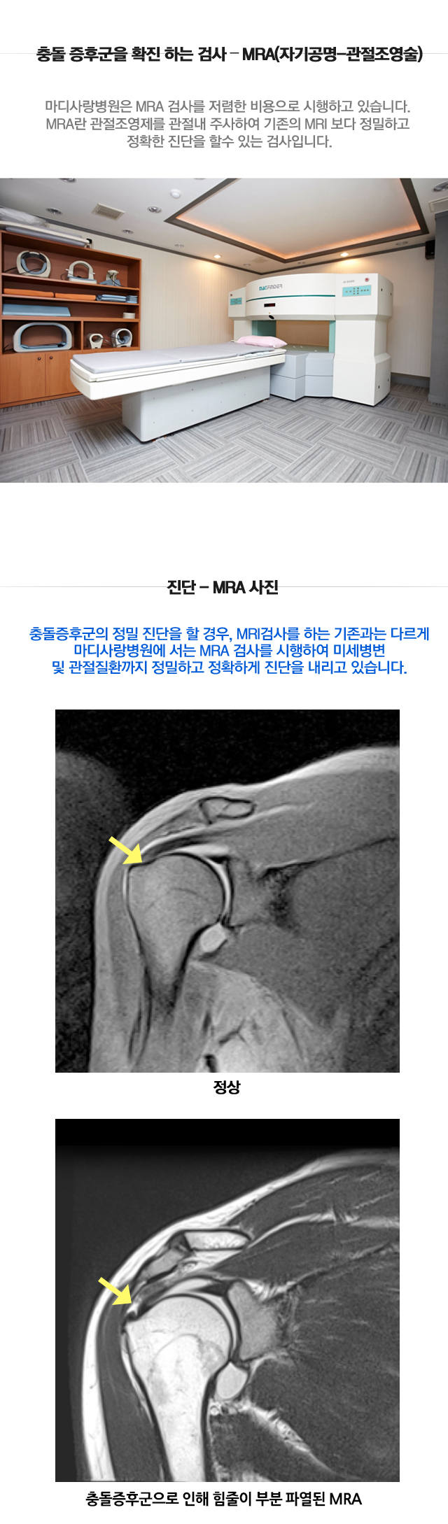 충돌증후군