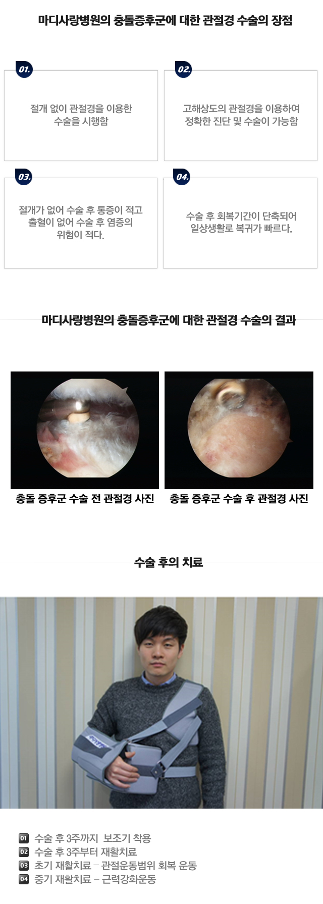 충돌증후군