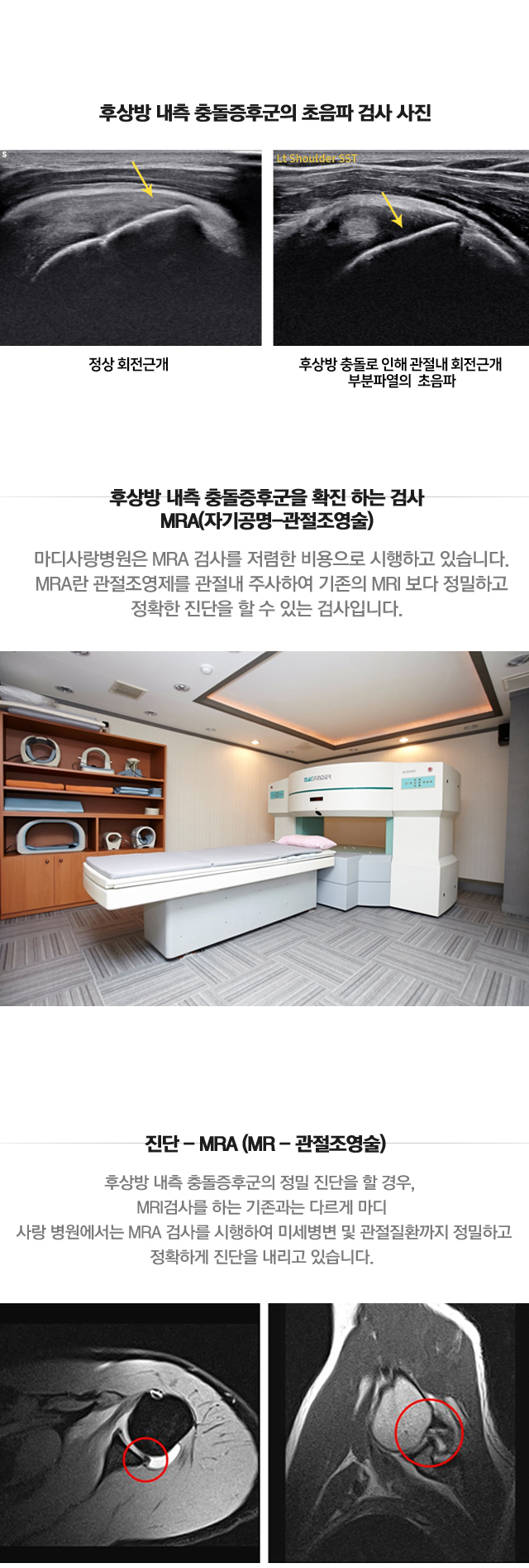 후상방 내측충돌증후군