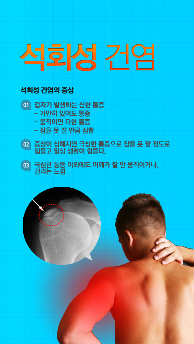 석회성건염