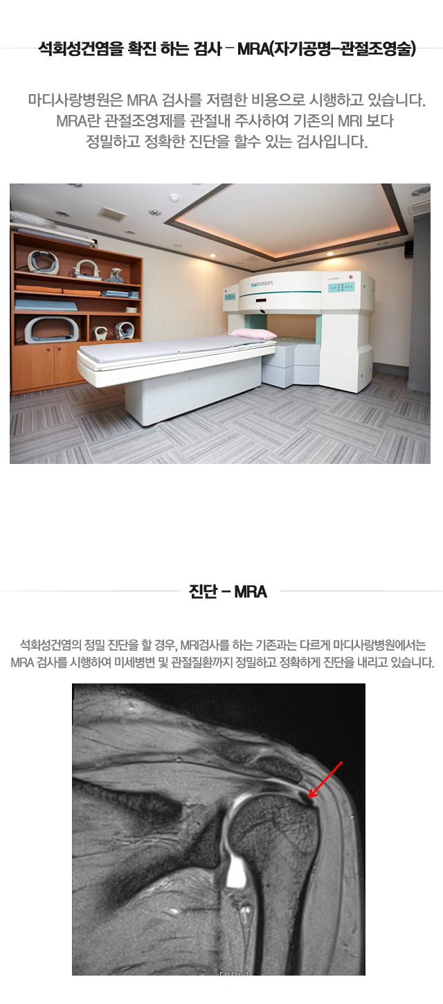 석회성건염