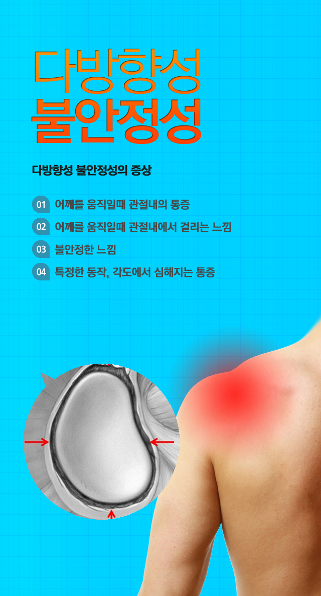 불안정성