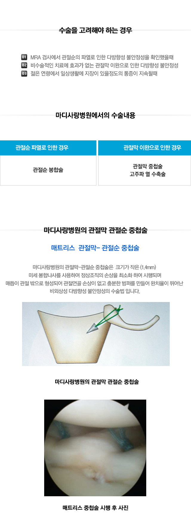 불안정성