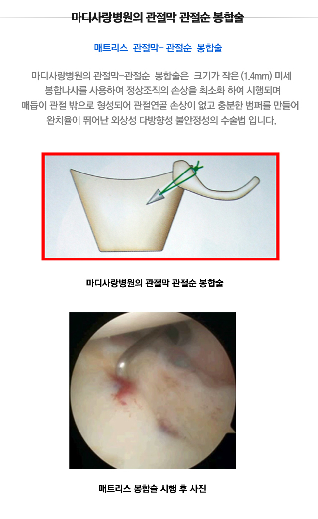 불안정성