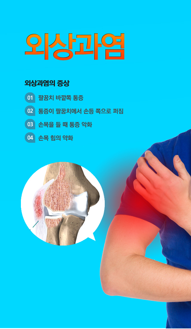 외상과염