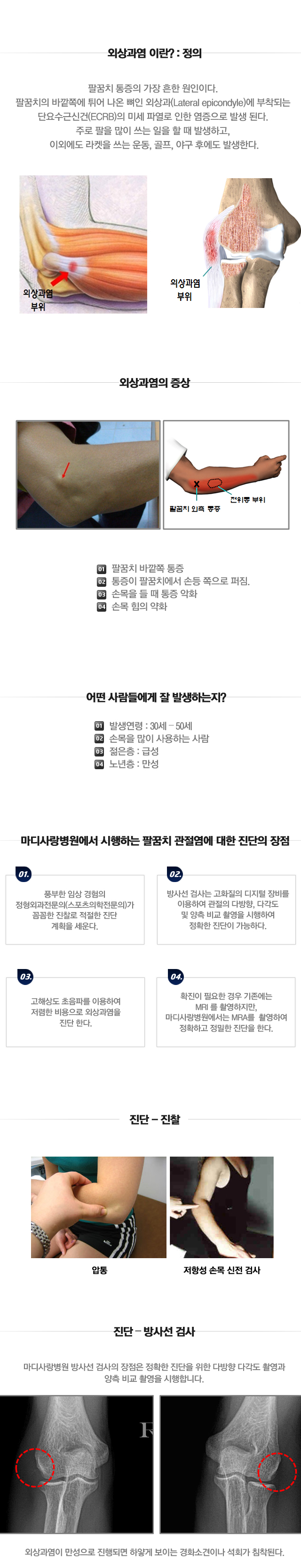 외상과염