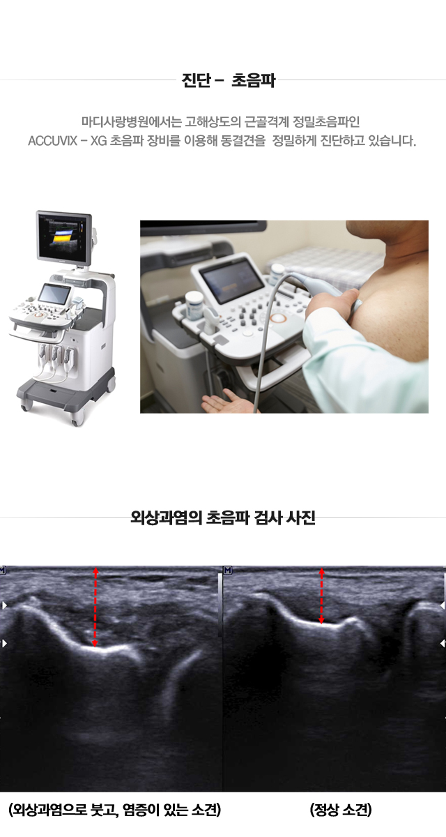 외상과염