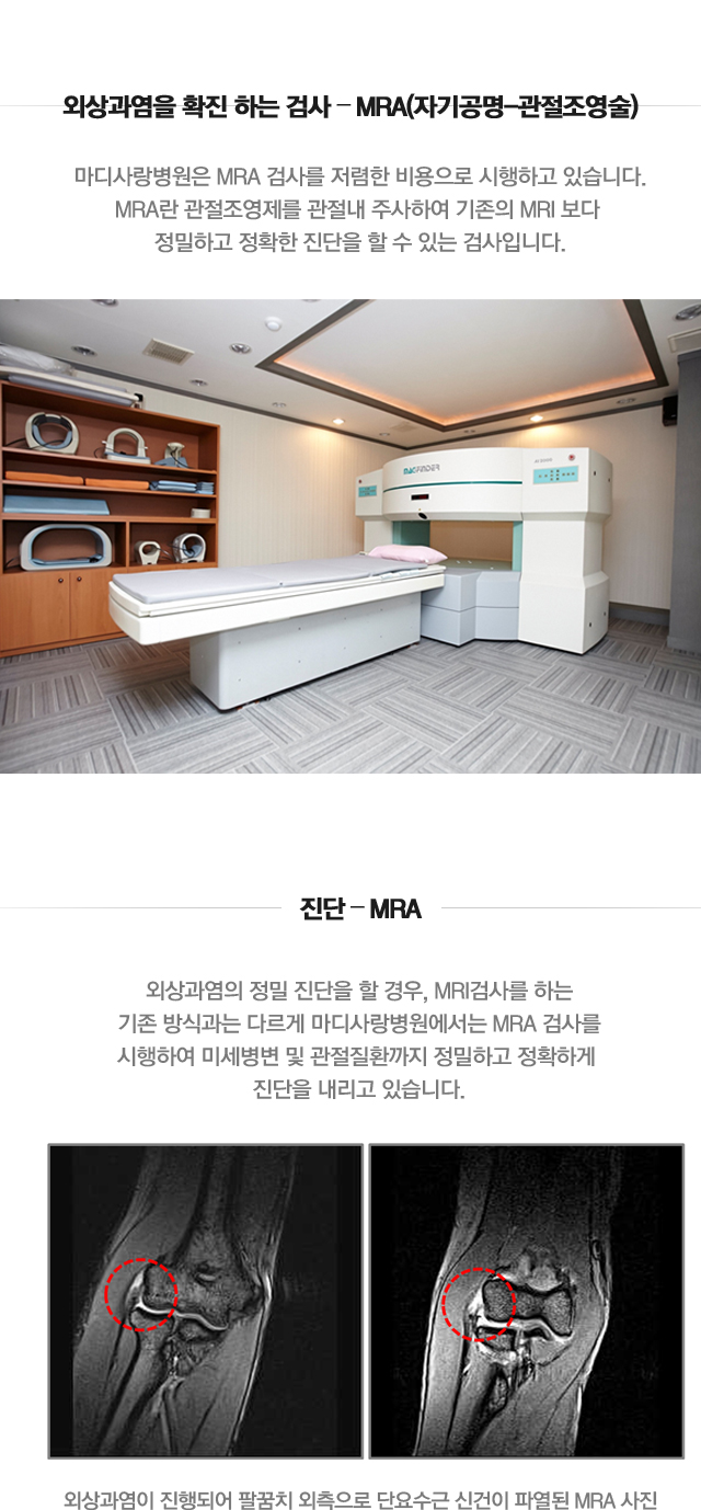 외상과염