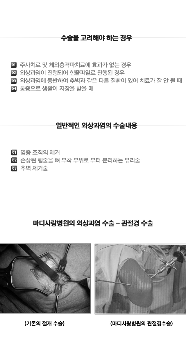 외상과염
