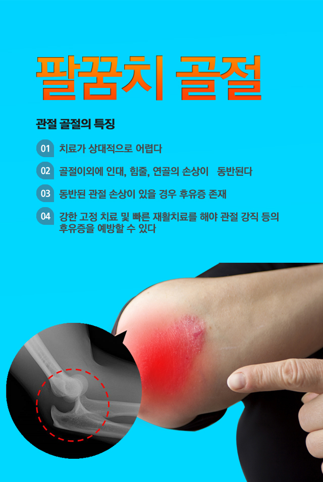 팔꿈치골절