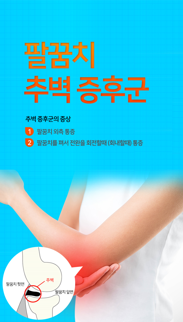 팔꿈치 추벽 증후군
